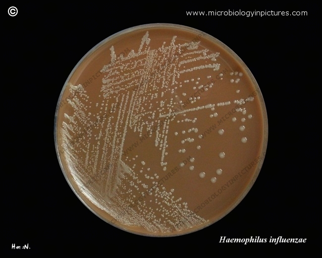 Which Bacteria Have Polysaccharide Capsule Which Bacteria Have Polysaccharide Capsule